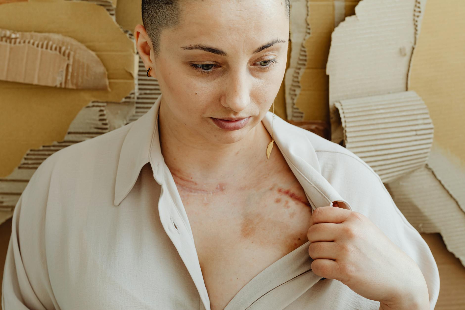 Bayhan Survivor injury